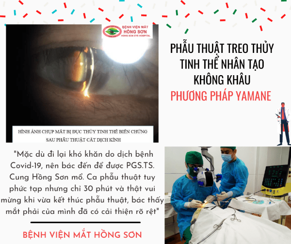 Chuyên đề: PHẪU THUẬT TREO THỦY TINH THỂ NHÂN TẠO KHÔNG KHÂU - PHƯƠNG PHÁP YAMANE 